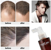 تونیک احیای مو مکس کر